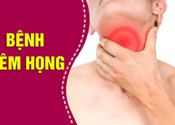 benh viem hong