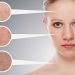 Dùng BHA bị đẩy mụn phải làm sao? Có nên nặn không?