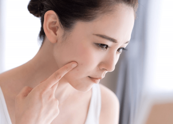 moi nan mun xong boi retinol duoc khong