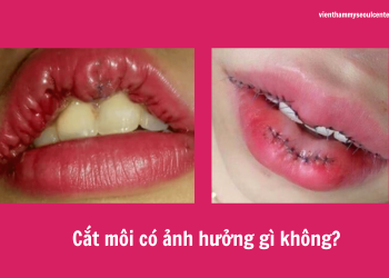 Cắt môi có ảnh hưởng gì không? Hậu quả nên cân nhắc