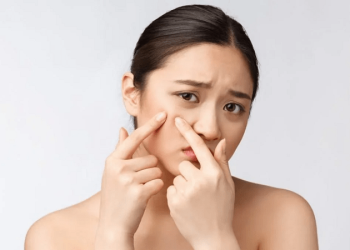 da dau mun co nen dung vitamin e khong